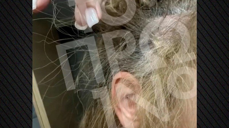 43χρονη έπεσε θύμα ξυλοδαρμού στη μέση του δρόμου από πλαστικό χειρούργο